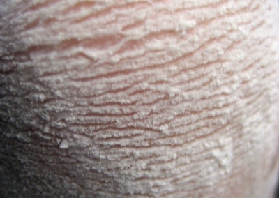 Photography of different materials on my skin, creating an abstract landscape of canyons.