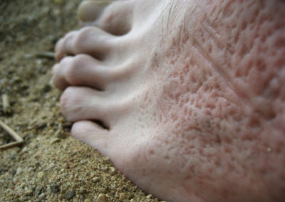 Photography of a foot with imprints of the sand it had just been pushed into before.